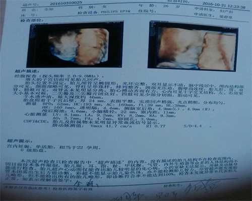 广东代孕多少钱：孕期1-9周胎儿图及B超下图片展