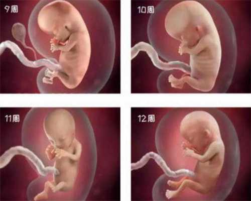 乌克兰专业代孕机构:五洲妇儿医院专家解答孕早