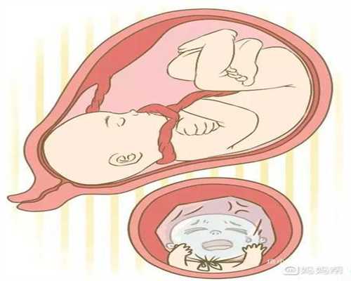 代孕期间吃酸辣有影响吗:香港捐卵代孕包成:乌克