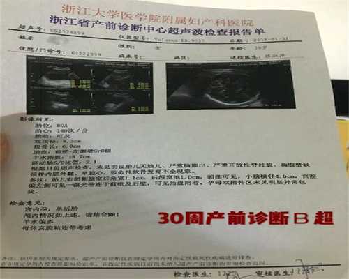 北京试管代孕:血糖偏高