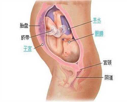代孕在哪找～卵巢囊肿需要动手术吗～女性是否